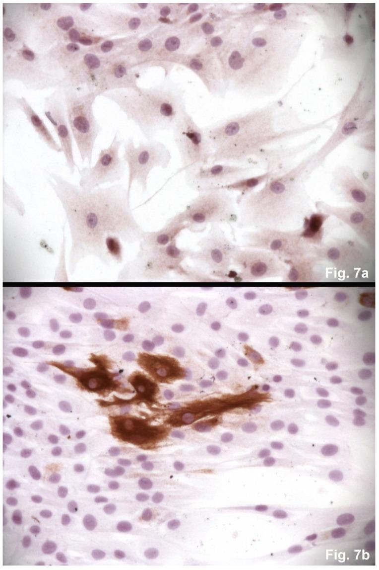 https://cdn.ncbi.nlm.nih.gov/pmc/blobs/9ff5/5859766/14d07c15bb22/ijmsv15p0436g007.jpg
