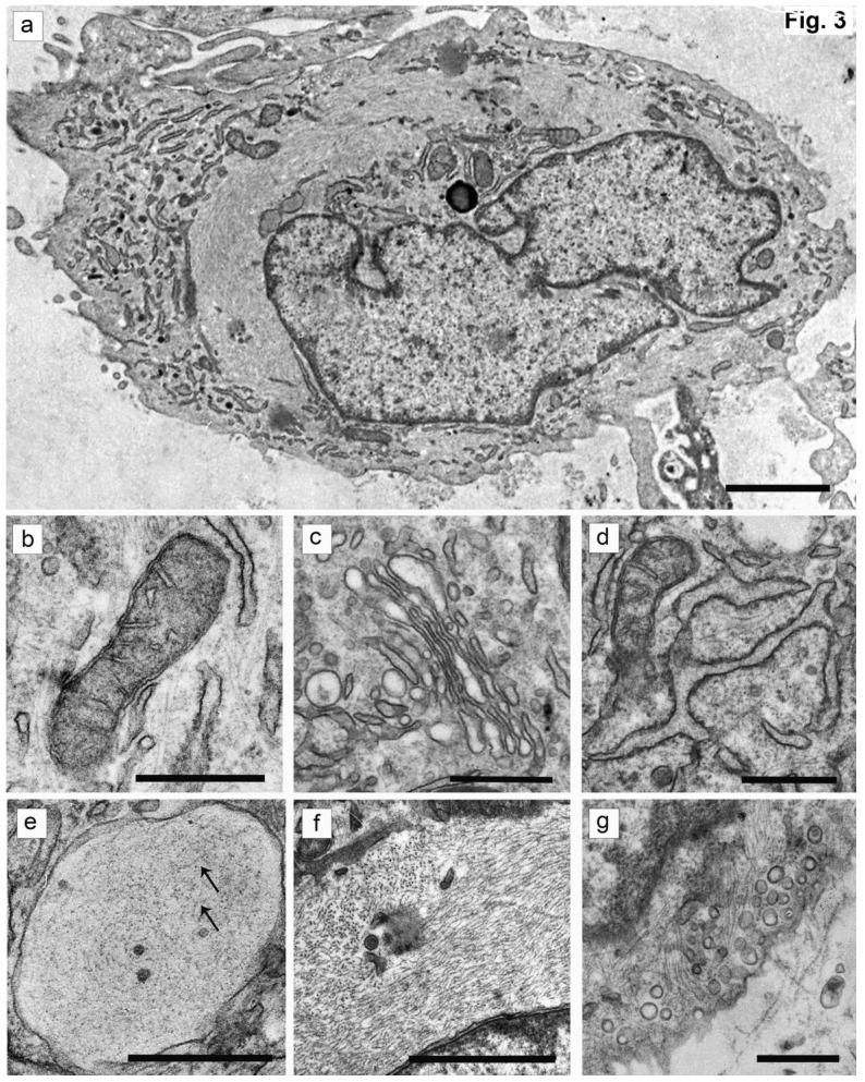 https://cdn.ncbi.nlm.nih.gov/pmc/blobs/9ff5/5859766/f71f49fe98de/ijmsv15p0436g003.jpg
