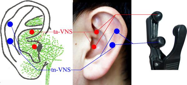 https://cdn.ncbi.nlm.nih.gov/pmc/blobs/9ff6/3537743/4de2bf6f107d/1472-6882-12-255-2.jpg