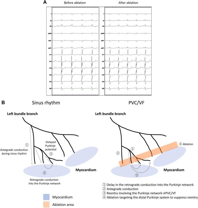 https://cdn.ncbi.nlm.nih.gov/pmc/blobs/9ffa/10511930/593e5c49f77b/gr3.jpg
