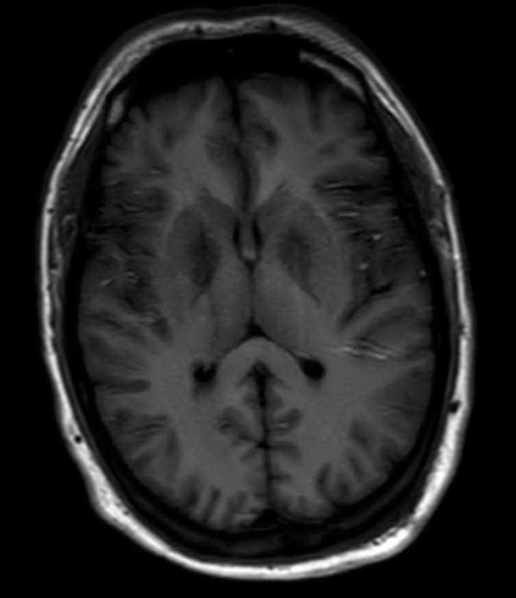 https://cdn.ncbi.nlm.nih.gov/pmc/blobs/9ffb/7746039/1db849d3b307/smrj_2017_2_1_6343_16569.jpg