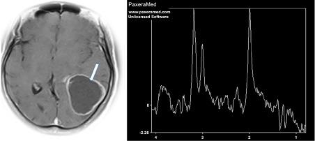 https://cdn.ncbi.nlm.nih.gov/pmc/blobs/a004/8811616/9cd026417347/CMIM-17-904_S1.jpg
