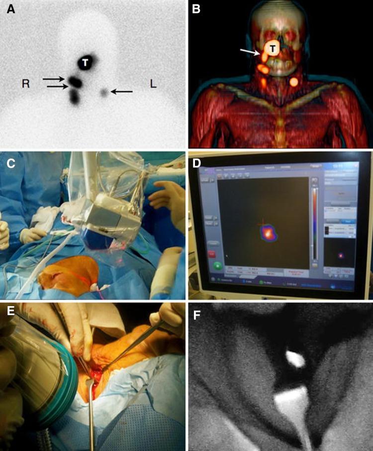 https://cdn.ncbi.nlm.nih.gov/pmc/blobs/a005/5532406/ddac9287d348/40336_2017_235_Fig2_HTML.jpg
