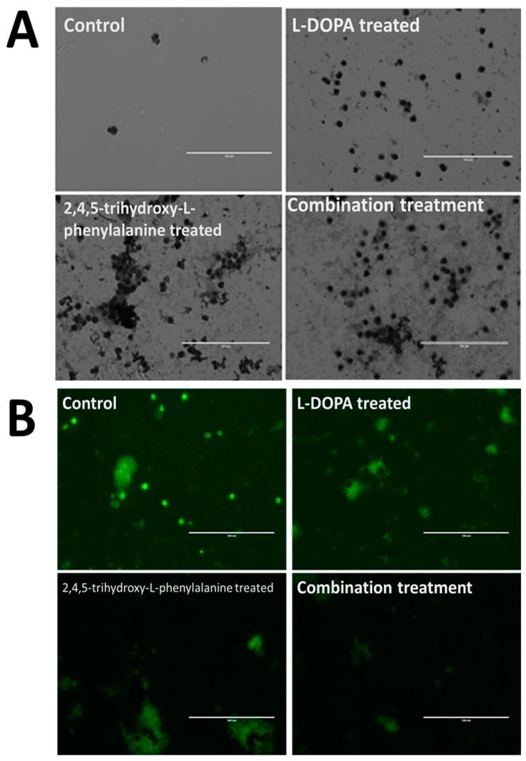 https://cdn.ncbi.nlm.nih.gov/pmc/blobs/a00c/6572089/6bce656c2173/biomolecules-09-00175-g005.jpg