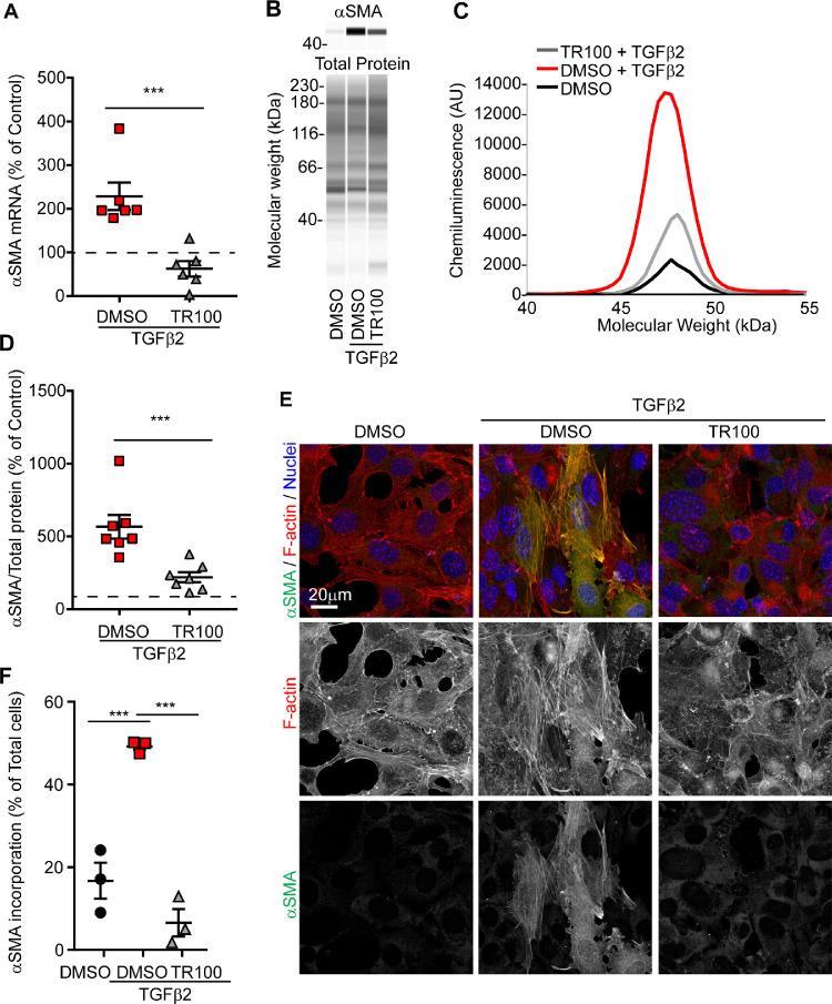 https://cdn.ncbi.nlm.nih.gov/pmc/blobs/a00e/7415280/52764aa2f097/iovs-61-6-2-f004.jpg