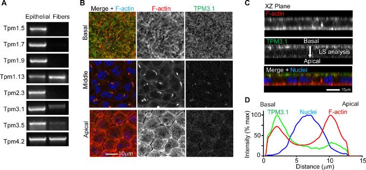 https://cdn.ncbi.nlm.nih.gov/pmc/blobs/a00e/7415280/743ad1643d93/iovs-61-6-2-f005.jpg
