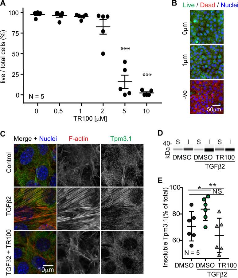 https://cdn.ncbi.nlm.nih.gov/pmc/blobs/a00e/7415280/aeebef2c5e29/iovs-61-6-2-f003.jpg