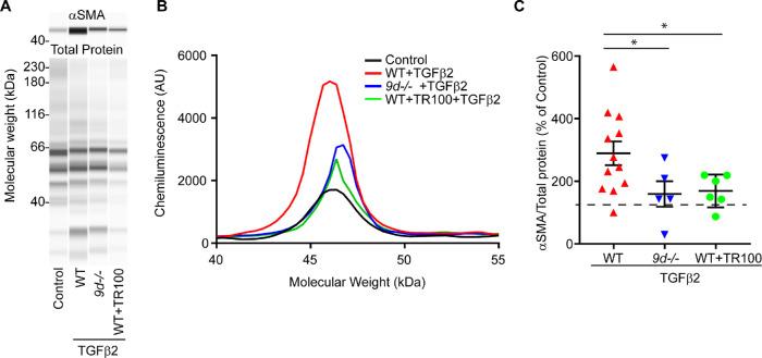 https://cdn.ncbi.nlm.nih.gov/pmc/blobs/a00e/7415280/df0d598a1685/iovs-61-6-2-f008.jpg