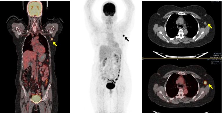 https://cdn.ncbi.nlm.nih.gov/pmc/blobs/a00f/10909089/13bf8ec72f5c/APJCP-24-4053-g004.jpg