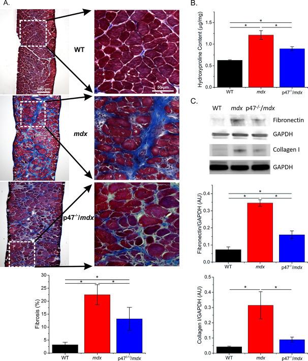 https://cdn.ncbi.nlm.nih.gov/pmc/blobs/a00f/5812717/715b25e2c253/elife-31732-fig2.jpg