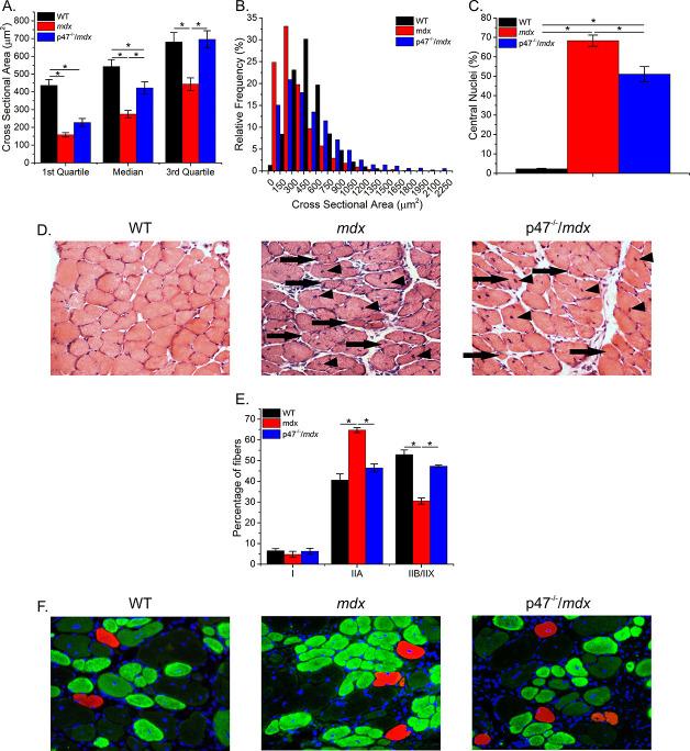 https://cdn.ncbi.nlm.nih.gov/pmc/blobs/a00f/5812717/b9706a4769ad/elife-31732-fig4-figsupp1.jpg