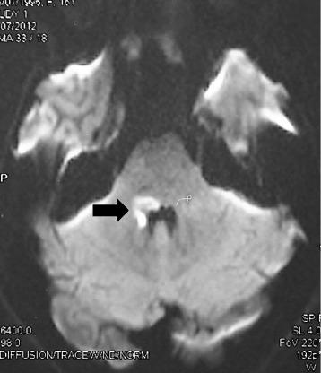 https://cdn.ncbi.nlm.nih.gov/pmc/blobs/a012/4328076/e9b7117e812d/13104_2015_991_Fig2_HTML.jpg