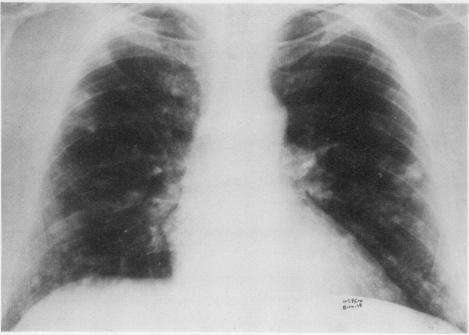 https://cdn.ncbi.nlm.nih.gov/pmc/blobs/a01b/470264/bc9079bade74/thorax00140-0060-a.jpg