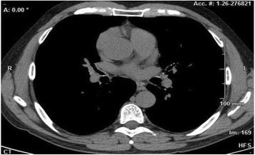 https://cdn.ncbi.nlm.nih.gov/pmc/blobs/a01b/4836196/36956fbac01c/40248_2016_50_Fig4_HTML.jpg
