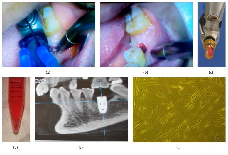 https://cdn.ncbi.nlm.nih.gov/pmc/blobs/a01c/4826948/1cb4cbd4c786/SCI2016-8741641.001.jpg