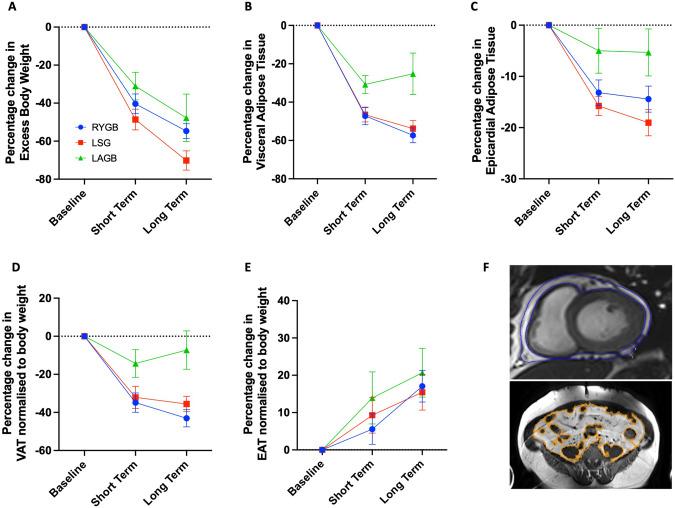 https://cdn.ncbi.nlm.nih.gov/pmc/blobs/a01d/11129945/b912a0df31db/41366_2024_1474_Fig1_HTML.jpg
