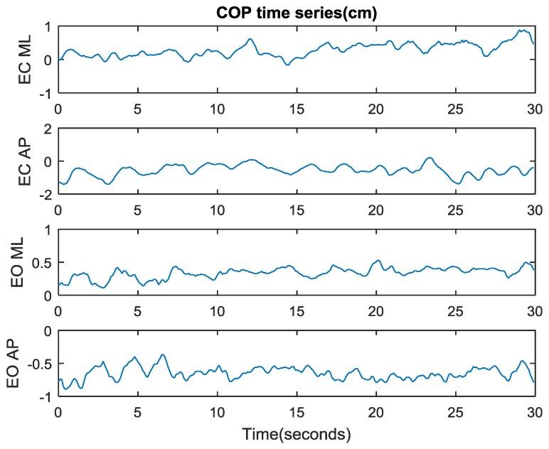 https://cdn.ncbi.nlm.nih.gov/pmc/blobs/a01d/5375905/bdb98bc90328/sensors-17-00619-g006.jpg