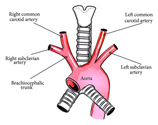https://cdn.ncbi.nlm.nih.gov/pmc/blobs/a01e/4102086/de557db58807/TSWJ2014-292734.001.jpg