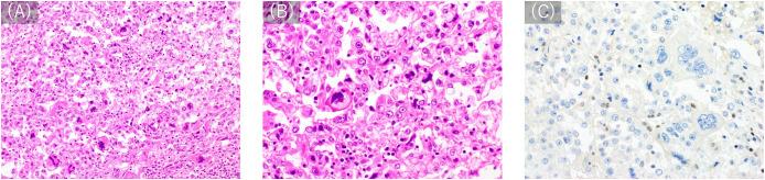 https://cdn.ncbi.nlm.nih.gov/pmc/blobs/a01f/12170289/c969d2a413d0/fonc-15-1552411-g001.jpg