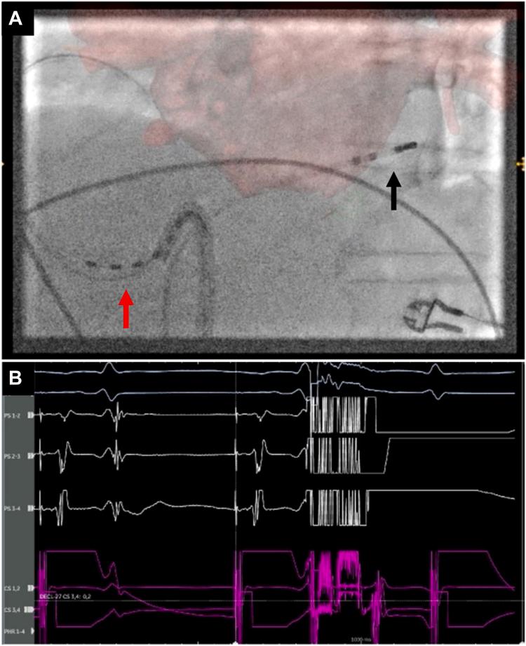 https://cdn.ncbi.nlm.nih.gov/pmc/blobs/a031/12242975/0a12162b0c63/gr1.jpg
