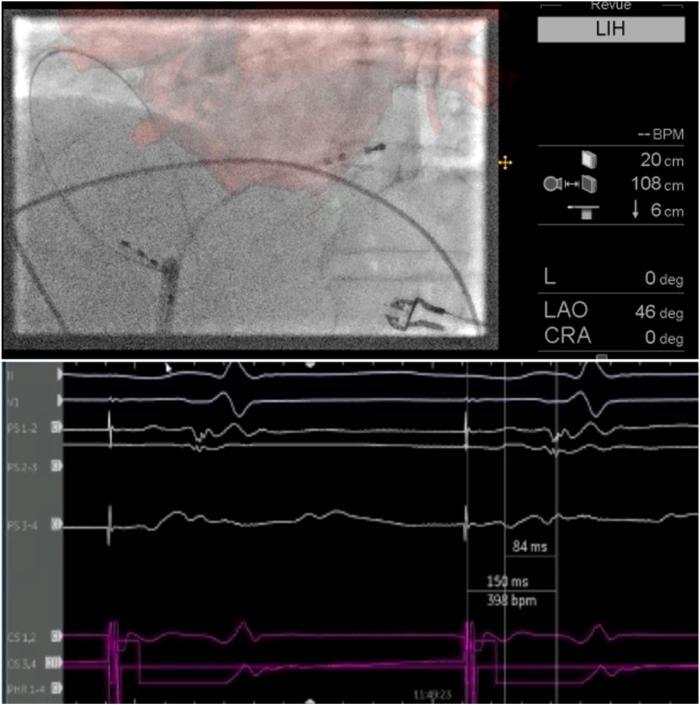 https://cdn.ncbi.nlm.nih.gov/pmc/blobs/a031/12242975/311249d2f0b0/gr2.jpg