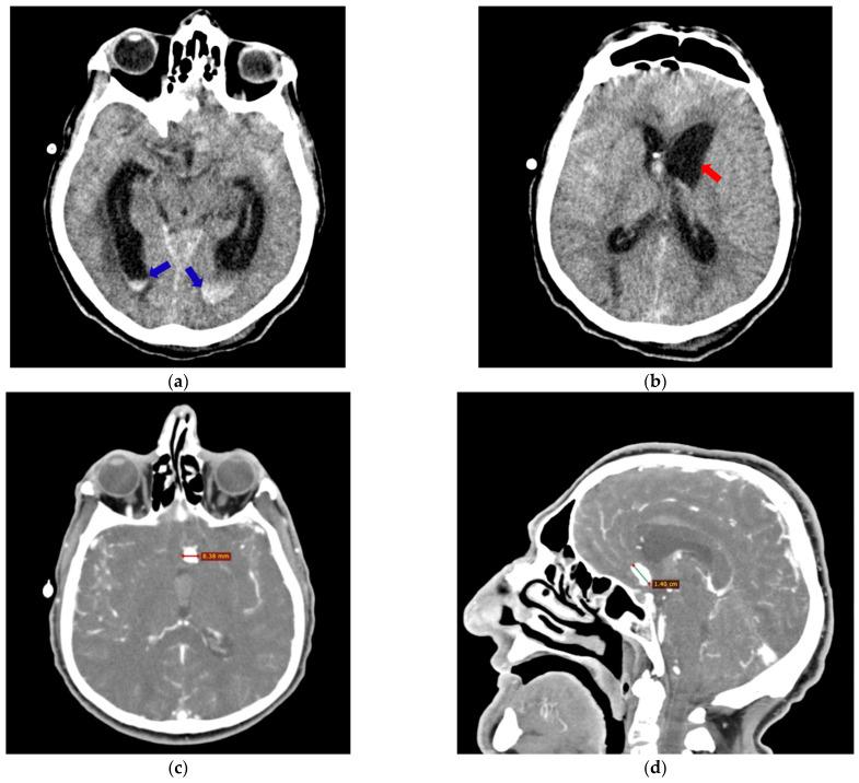 https://cdn.ncbi.nlm.nih.gov/pmc/blobs/a036/12371958/92f66199a730/neurosci-06-00081-g001.jpg