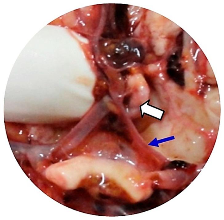 https://cdn.ncbi.nlm.nih.gov/pmc/blobs/a036/12371958/d810e77ed05f/neurosci-06-00081-g002.jpg