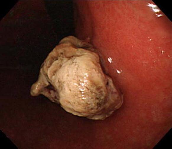 https://cdn.ncbi.nlm.nih.gov/pmc/blobs/a03b/3264870/b85cb3afa7f6/595_2011_77_Fig1_HTML.jpg