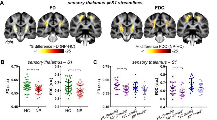 https://cdn.ncbi.nlm.nih.gov/pmc/blobs/a03c/11726370/2b4aaf98b74c/HBM-46-e70135-g009.jpg