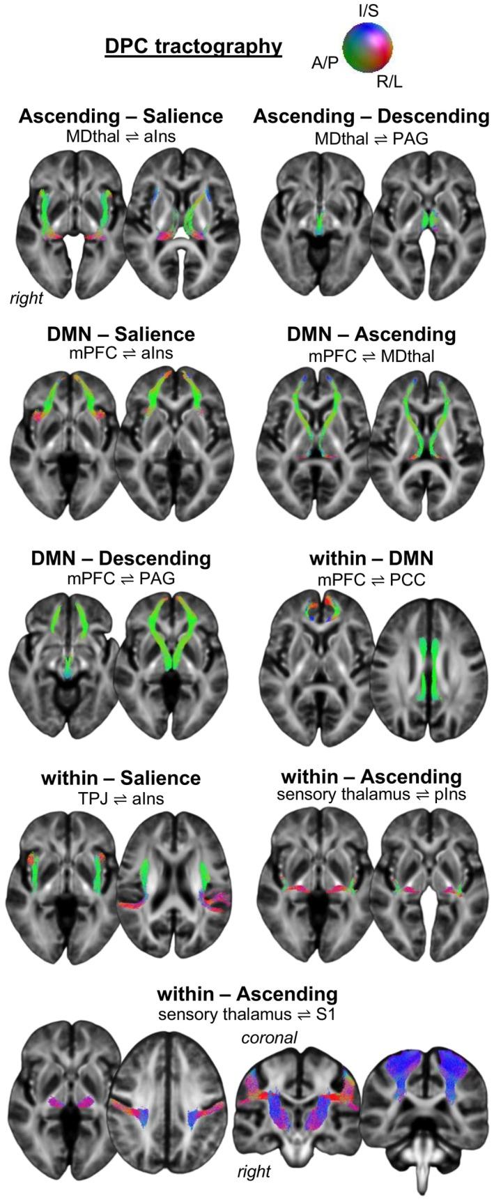 https://cdn.ncbi.nlm.nih.gov/pmc/blobs/a03c/11726370/54fcf94ce030/HBM-46-e70135-g004.jpg