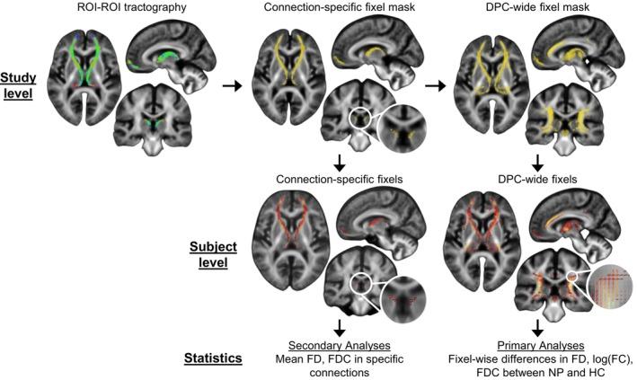 https://cdn.ncbi.nlm.nih.gov/pmc/blobs/a03c/11726370/5b9741879230/HBM-46-e70135-g003.jpg