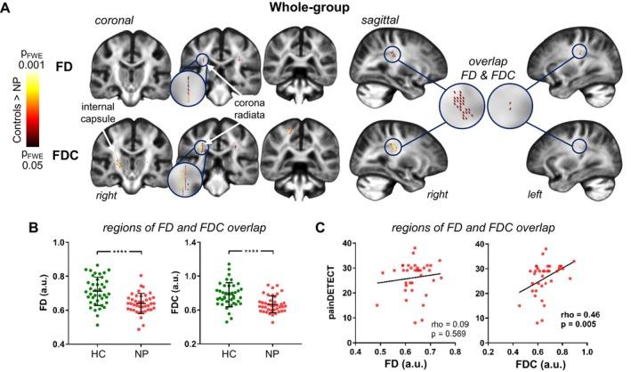 https://cdn.ncbi.nlm.nih.gov/pmc/blobs/a03c/11726370/f6a7339eeaab/HBM-46-e70135-g007.jpg