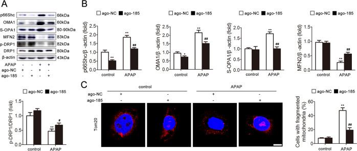 https://cdn.ncbi.nlm.nih.gov/pmc/blobs/a03d/7648761/08be5a57bc94/41419_2020_3160_Fig5_HTML.jpg
