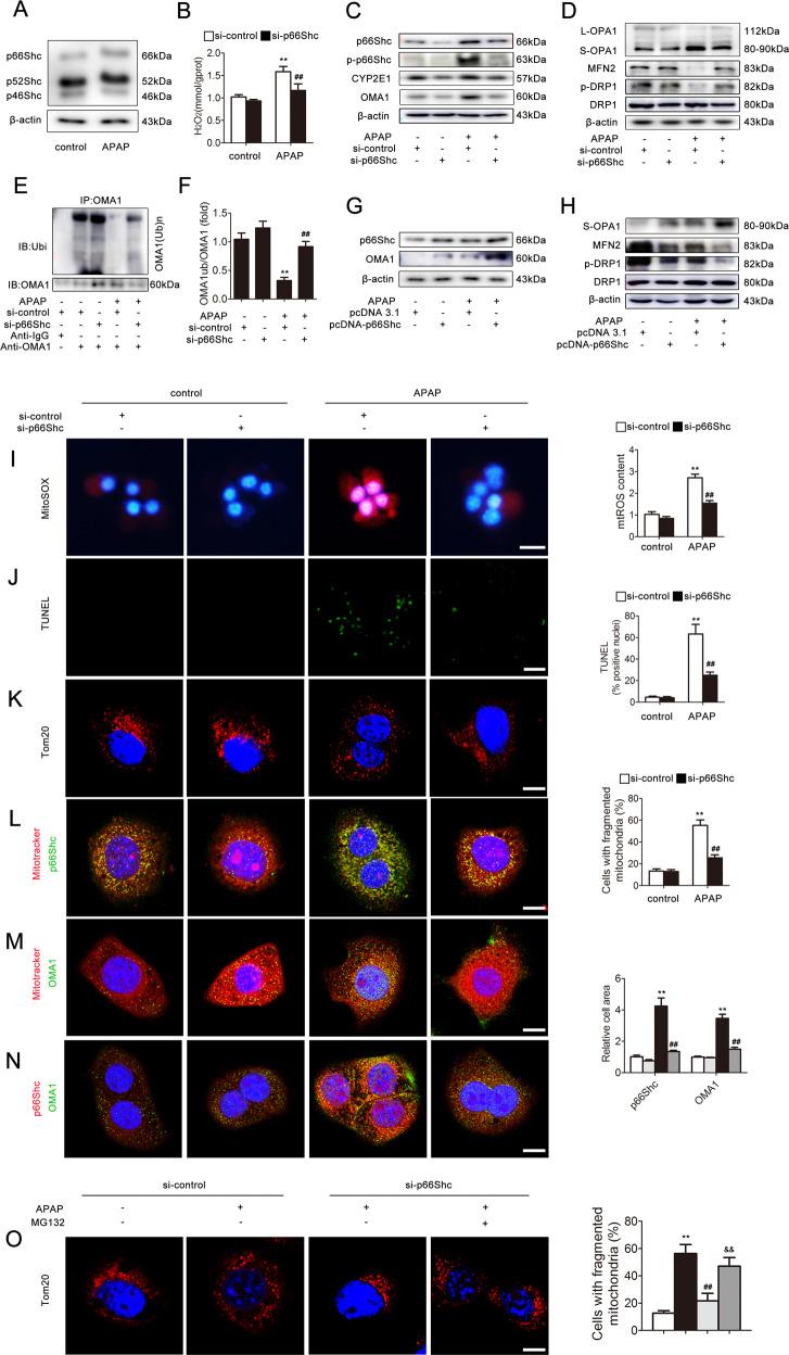 https://cdn.ncbi.nlm.nih.gov/pmc/blobs/a03d/7648761/d0273447014d/41419_2020_3160_Fig2_HTML.jpg
