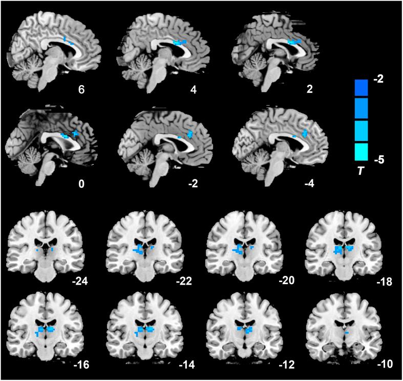 https://cdn.ncbi.nlm.nih.gov/pmc/blobs/a03e/5122858/add52cc2b999/srep37617-f2.jpg