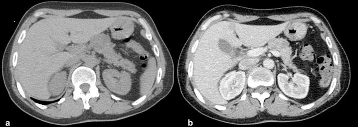 https://cdn.ncbi.nlm.nih.gov/pmc/blobs/a03e/5633824/317208a685a0/gr1.jpg