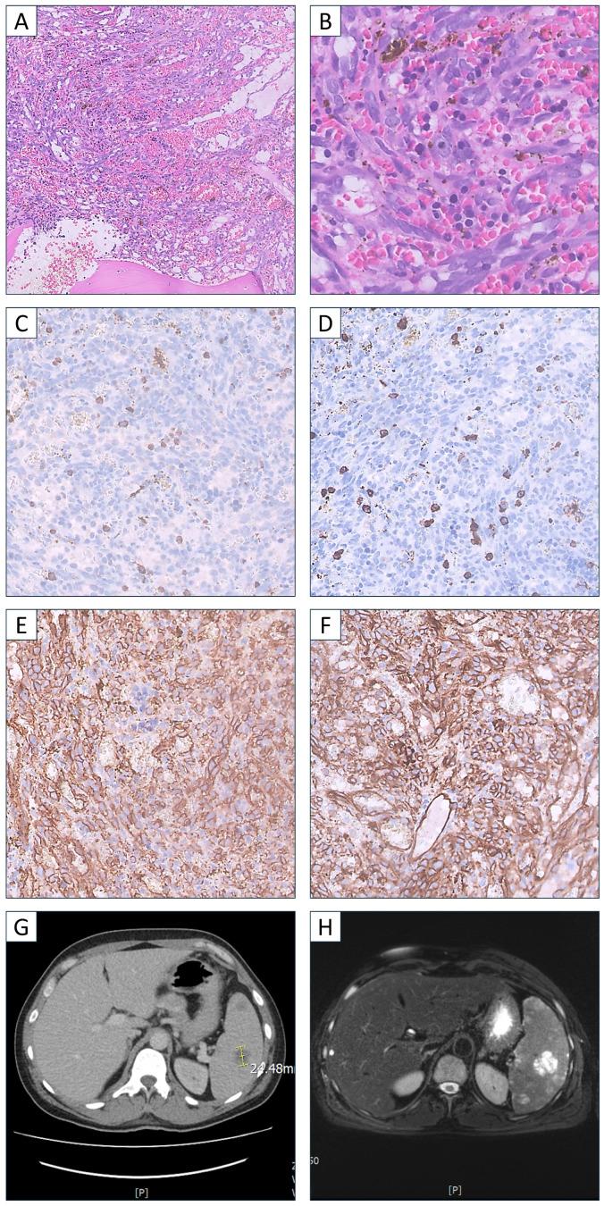 https://cdn.ncbi.nlm.nih.gov/pmc/blobs/a042/11503393/e8cd804b381e/hematolrep-16-00063-g001.jpg