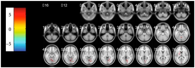 https://cdn.ncbi.nlm.nih.gov/pmc/blobs/a042/9599805/02e4d87c1a5c/brainsci-12-01344-g002.jpg