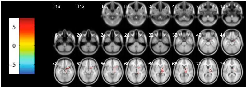 https://cdn.ncbi.nlm.nih.gov/pmc/blobs/a042/9599805/4e83ac3e02f8/brainsci-12-01344-g001.jpg