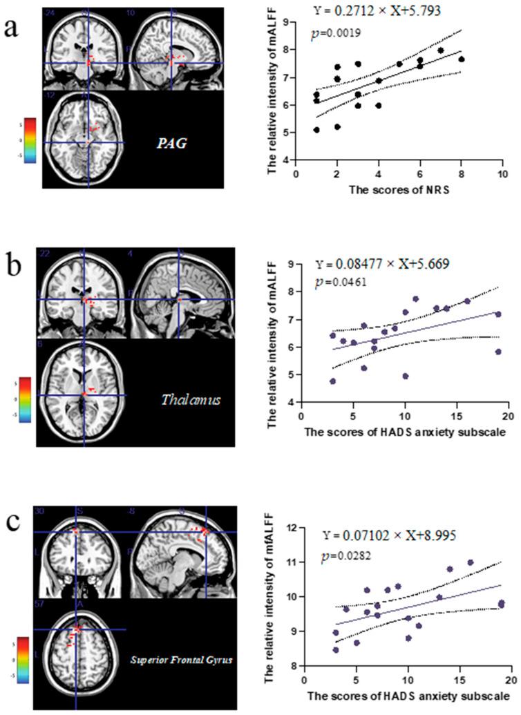 https://cdn.ncbi.nlm.nih.gov/pmc/blobs/a042/9599805/b2f436bab9bf/brainsci-12-01344-g003.jpg