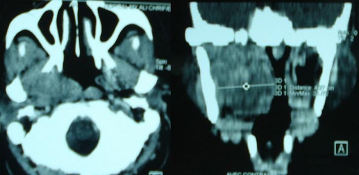 https://cdn.ncbi.nlm.nih.gov/pmc/blobs/a068/4765339/6532292b17b2/PAMJ-22-281-g002.jpg