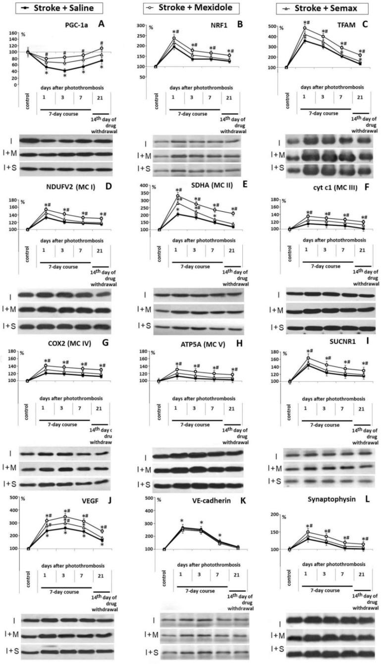 https://cdn.ncbi.nlm.nih.gov/pmc/blobs/a069/8002020/ed4966eef02a/brainsci-11-00325-g006.jpg