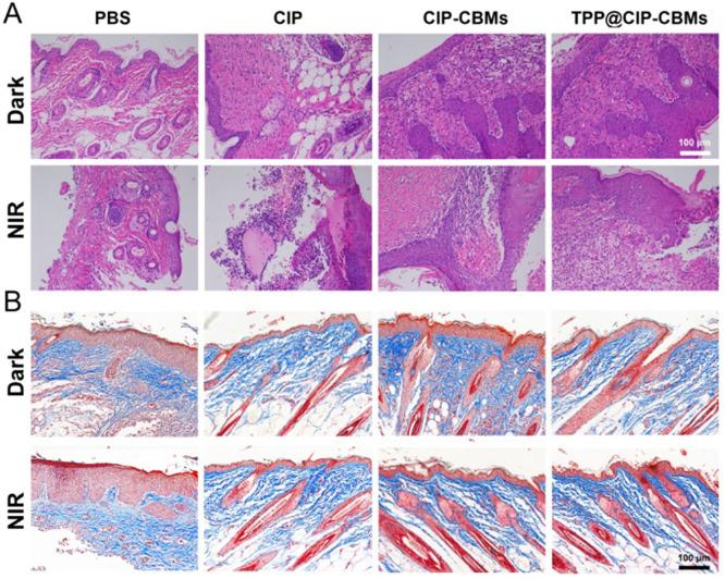 https://cdn.ncbi.nlm.nih.gov/pmc/blobs/a06c/10236462/46e314e448f1/gr9.jpg