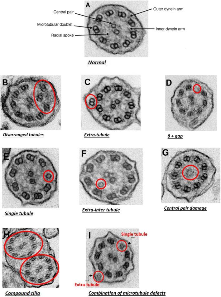 https://cdn.ncbi.nlm.nih.gov/pmc/blobs/a06e/7545929/6e6c6c914405/12931_2020_1506_Fig4_HTML.jpg