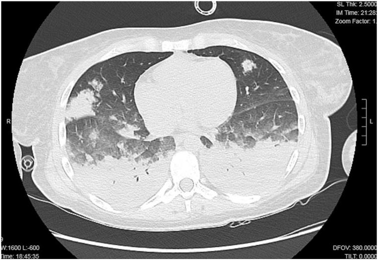 https://cdn.ncbi.nlm.nih.gov/pmc/blobs/a06f/12166702/43da66653f3f/gr2.jpg