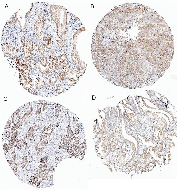 https://cdn.ncbi.nlm.nih.gov/pmc/blobs/a077/12124315/be3a38f5e871/OTT-18-679-g0005.jpg