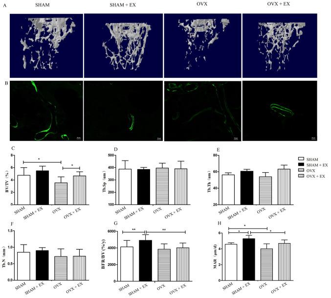 https://cdn.ncbi.nlm.nih.gov/pmc/blobs/a077/8649853/31f0e581bcd7/etm-23-01-10993-g01.jpg