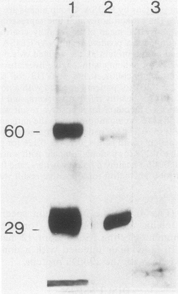 https://cdn.ncbi.nlm.nih.gov/pmc/blobs/a07b/265551/386efc564601/jcm00018-0018-a.jpg