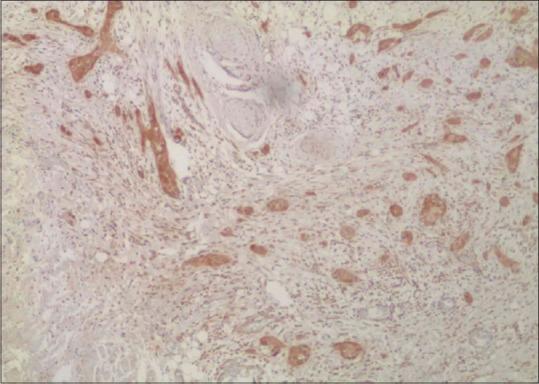 https://cdn.ncbi.nlm.nih.gov/pmc/blobs/a07d/10112077/4e2a0f71feb1/JOMFP-26-602-g005.jpg