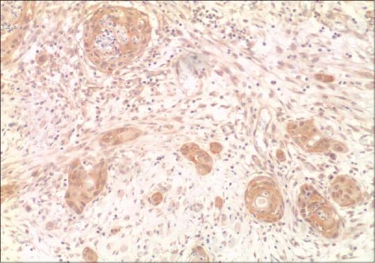 https://cdn.ncbi.nlm.nih.gov/pmc/blobs/a07d/10112077/ec05cdcfa7b8/JOMFP-26-602-g002.jpg
